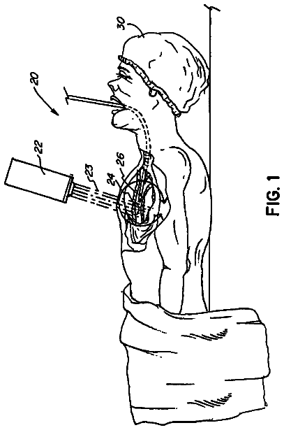 Drawing from US 10,029,115 B2