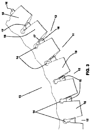 Drawing sheet 3 of US 11,160,649 B2