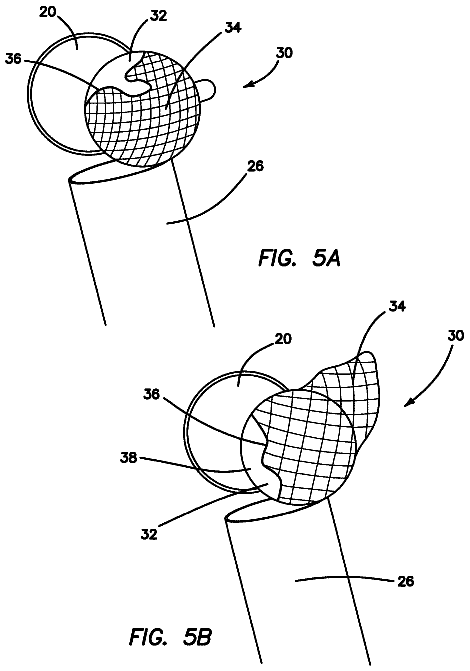 Drawing sheet 3 of US 11,161,015 B2