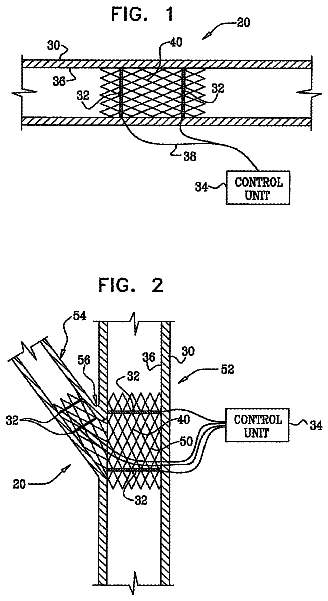 Drawing from US 11,197,992 B2