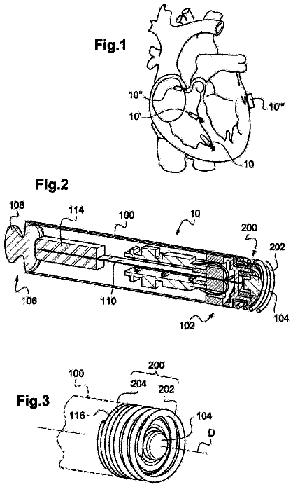 Drawing from US 11,197,997 B2