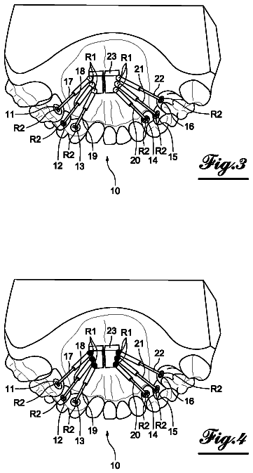 Drawing sheet 2 of US 11,219,508 B2