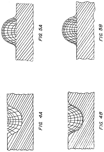 Drawing sheet 2 of US 6,038,704 A
