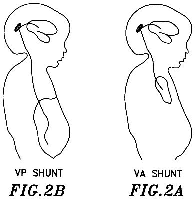 Drawing sheet 3 of US 6,241,660 B1