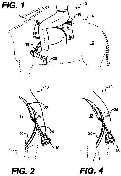 Drawing from US 6,568,940 B2