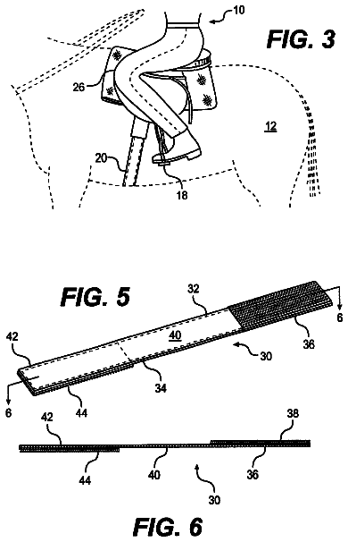 Drawing sheet 2 of US 6,568,940 B2