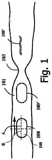 Drawing from US 8,523,788 B2