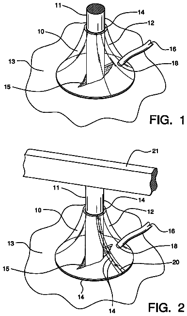 Drawing from US 8,523,859 B2