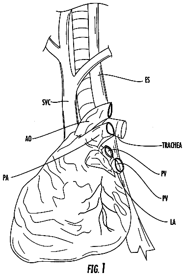 Drawing from US 8,529,443 B2