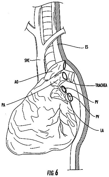 Drawing sheet 6 of US 8,529,443 B2