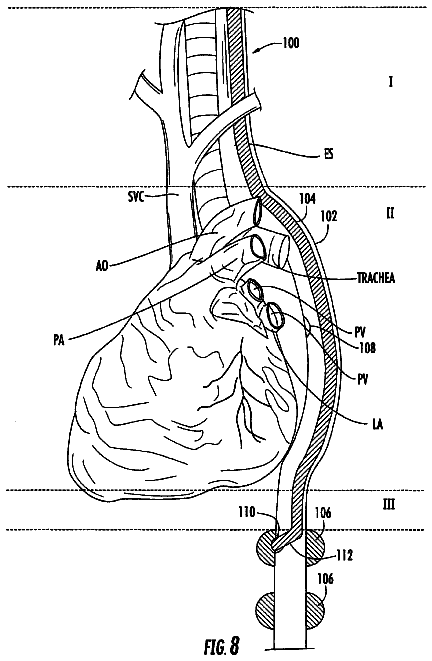 Drawing sheet 8 of US 8,529,443 B2