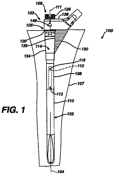 Drawing from US 8,529,578 B2
