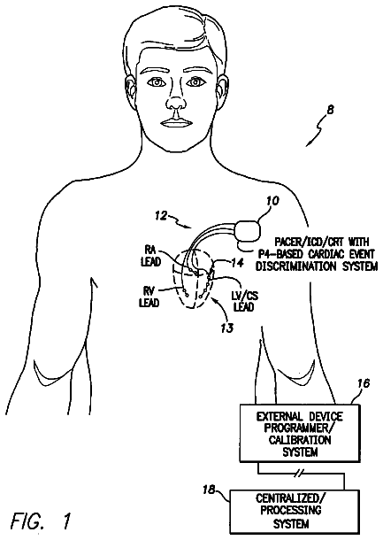 Drawing sheet 1 of US 8,538,524 B2
