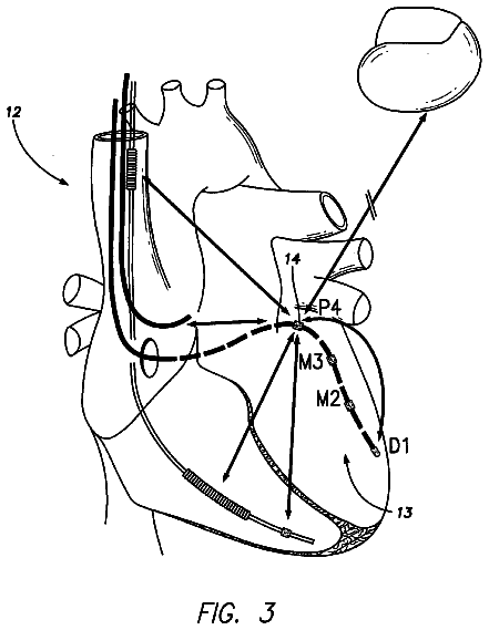 Drawing sheet 3 of US 8,538,524 B2
