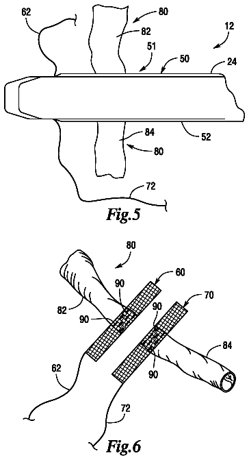 Drawing sheet 6 of US 8,540,131 B2