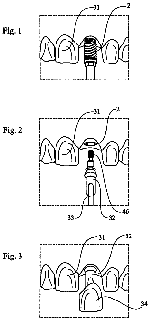 Drawing sheet 1 of US 8,540,510 B2