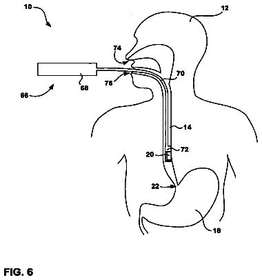 Drawing sheet 6 of US 8,540,679 B2