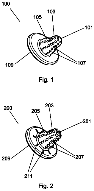 Drawing from US 8,545,537 B2