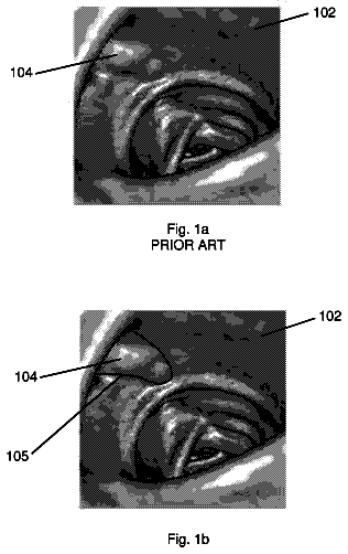Drawing from US 8,548,566 B2