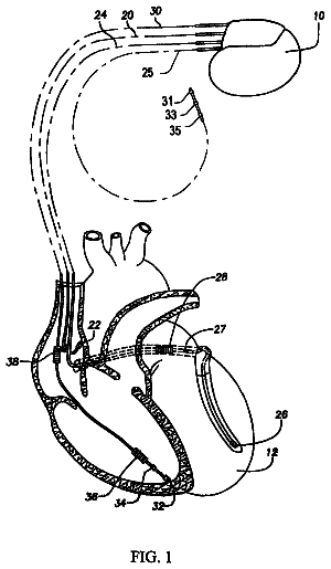Drawing from US 8,548,589 B2