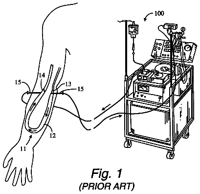 Drawing from US 8,551,033 B1