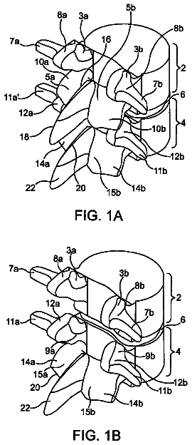 Drawing from US 8,551,142 B2