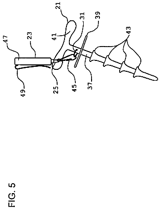 Drawing sheet 5 of US 8,556,295 B2