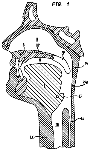 Drawing from US 8,561,617 B2