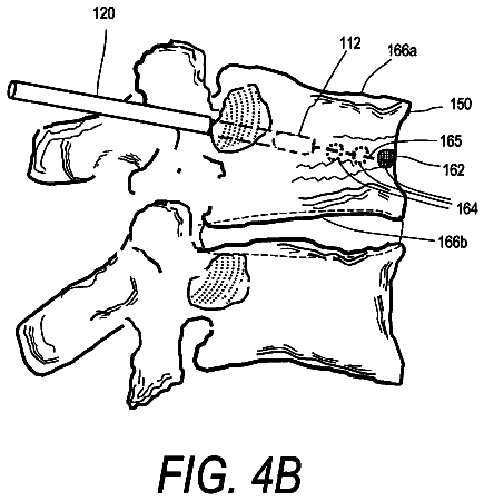 Drawing sheet 6 of US 8,562,607 B2