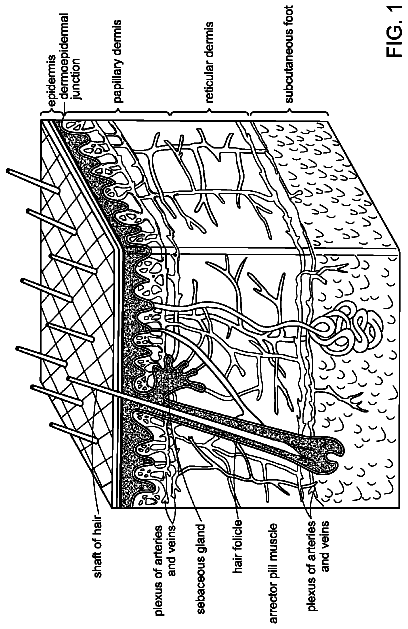 Drawing from US 8,562,626 B2