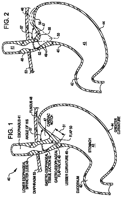 Drawing from US 8,568,429 B2