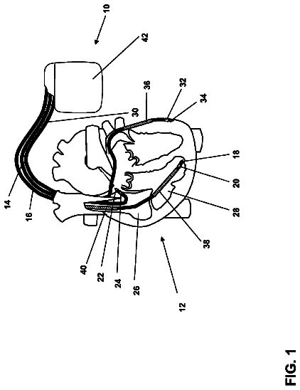 Drawing from US 8,571,641 B2