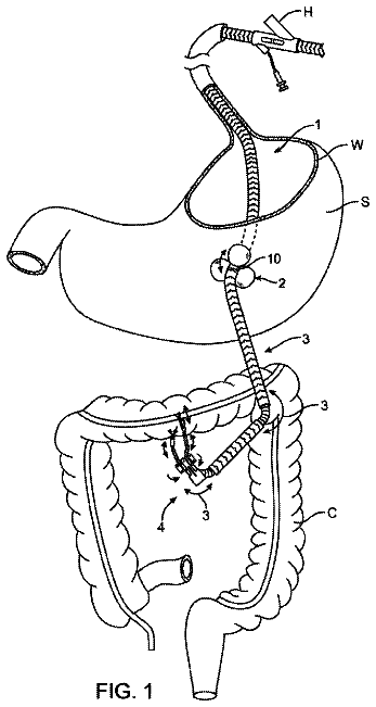 Drawing from US 8,573,226 B2