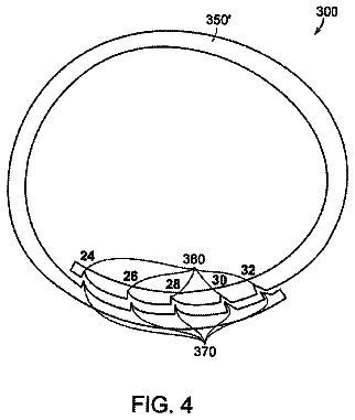 Drawing sheet 3 of US 8,574,290 B2