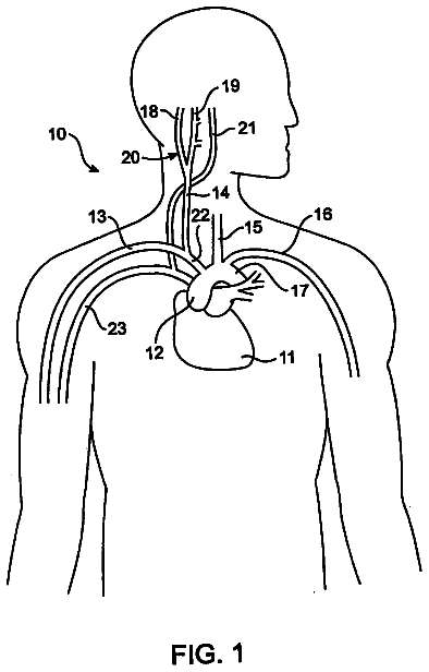 Drawing sheet 1 of US 8,583,236 B2