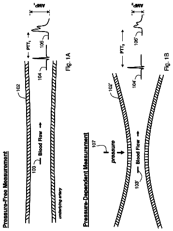 Drawing sheet 1 of US 8,602,997 B2