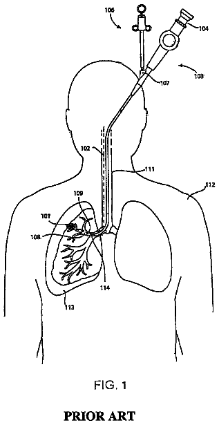 Drawing from US 8,611,983 B2