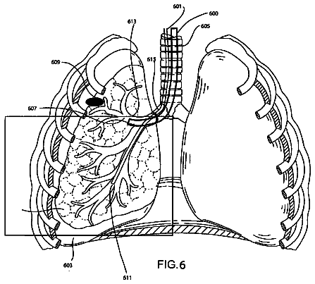 Drawing sheet 6 of US 8,611,983 B2