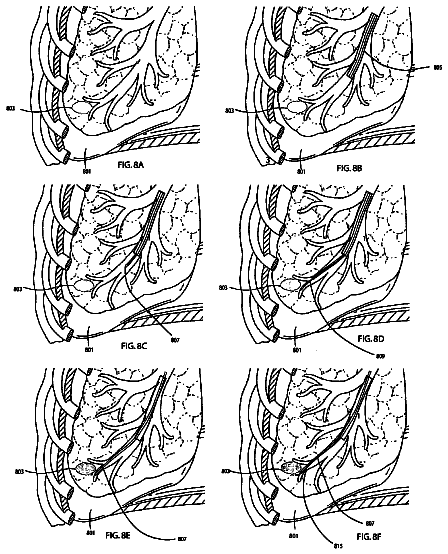 Drawing sheet 8 of US 8,611,983 B2