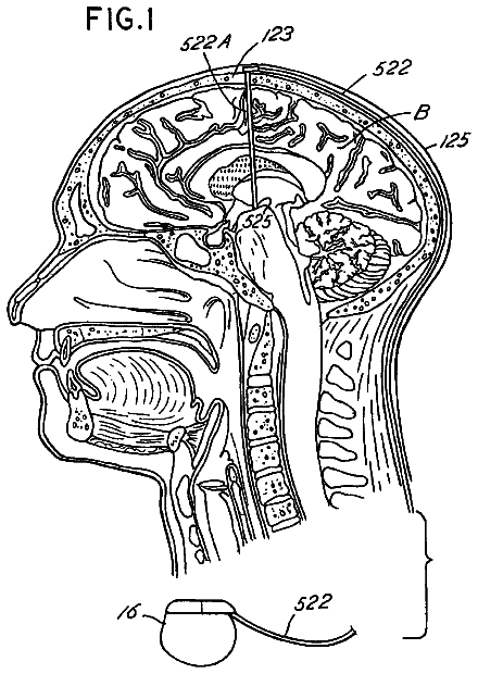 Drawing sheet 1 of US 8,612,006 B2