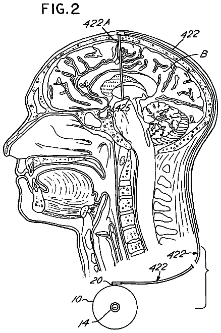 Drawing sheet 2 of US 8,612,006 B2