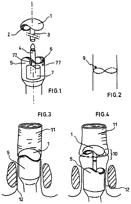 Drawing from US 8,613,384 B2