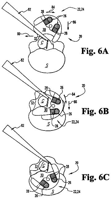 Drawing sheet 3 of US 8,613,769 B2
