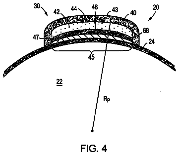 Drawing sheet 4 of US 8,622,856 B2