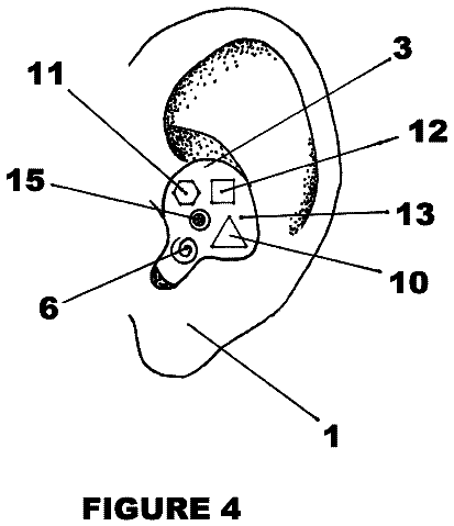 Drawing sheet 4 of US 8,622,885 B2