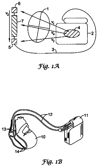 Drawing sheet 1 of US 8,626,285 B2