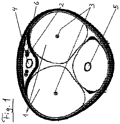 Drawing from US 8,628,466 B2