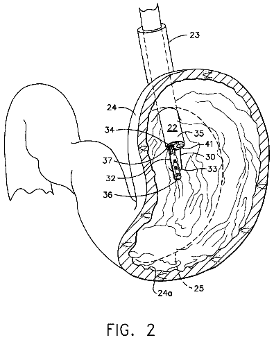 Drawing sheet 2 of US 8,628,553 B2