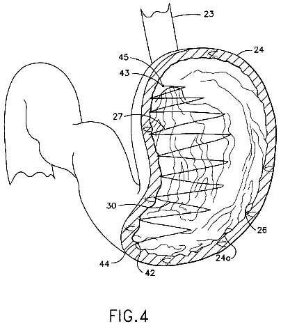Drawing sheet 4 of US 8,628,553 B2