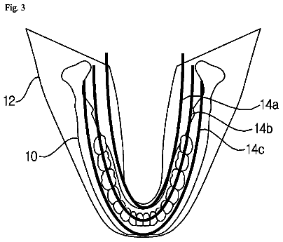 Drawing sheet 3 of US 8,634,621 B2